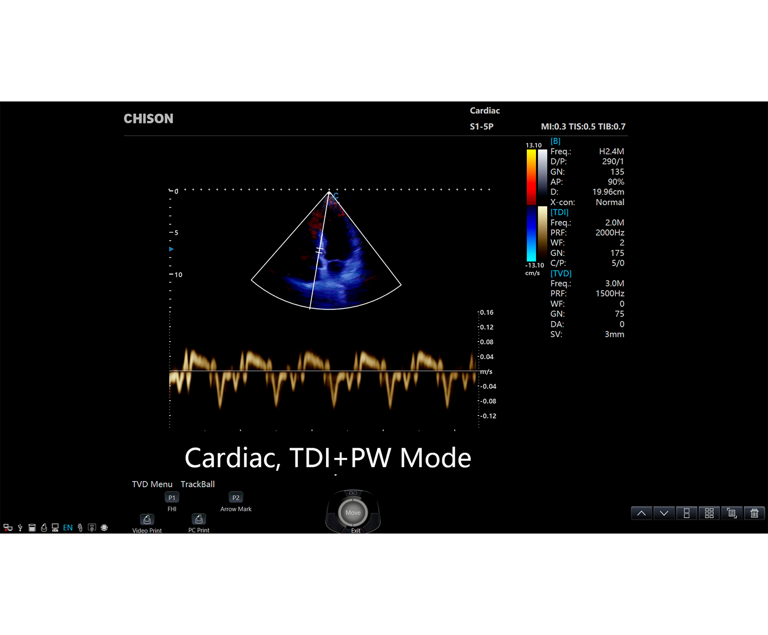 SonoPort Cardiac TDI PW
